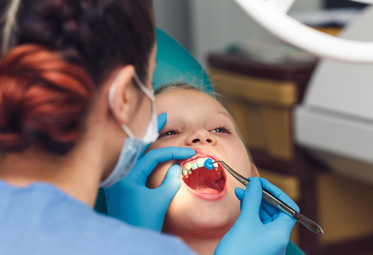 Fluoride Treatments