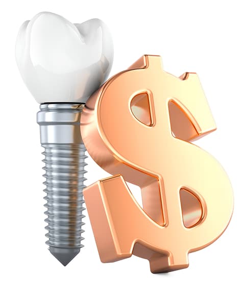 What Affects the Cost of Dental Implants?