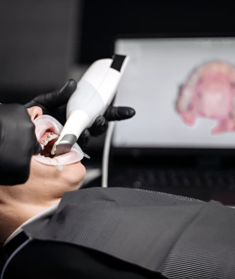 Dexis® Intraoral Camera