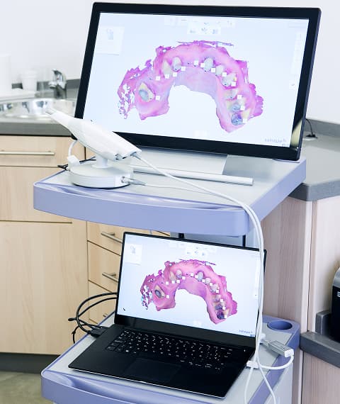 iTero Element 2 Digital Impression System