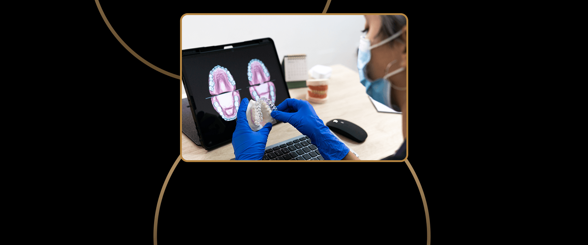 Invisalign Technology
