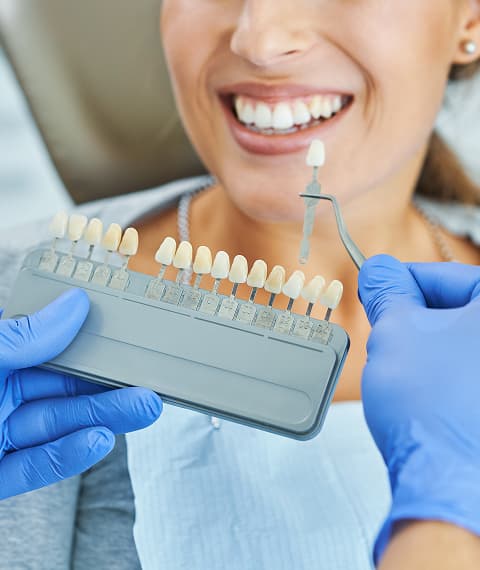 Porcelain Veneers