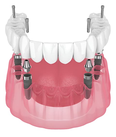 Why Choose Lynnhaven Dental?
