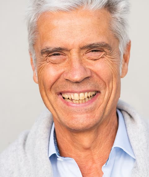 Benefits of Choosing Dental Implants