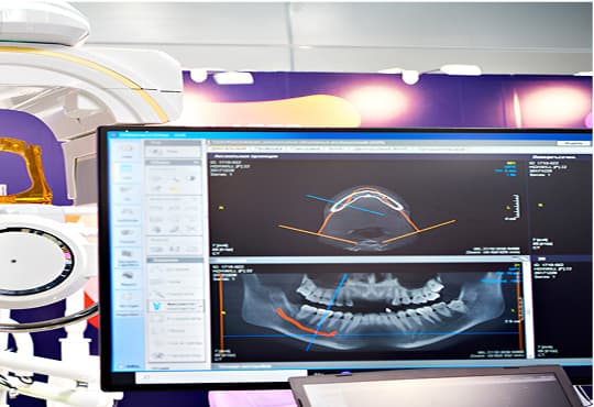 i3D Smart Scanner